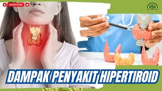 BERAT BADAN TURUN DRASTIS KARENA HIPERTIROID