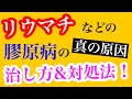 【リウマチ 治し方 原因】リウマチなどの膠原病の真の原因！組織破壊の仕組みと副腎疲労の関係性と治し方！！【副腎疲労症候群専門　整体　秋田市】