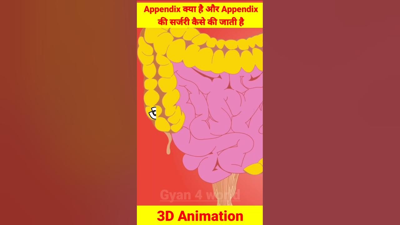 Appendix Operation 3D Animation Appendix Kya Hota Hai shorts appendix-operation-3d-animation-appendix-kya-hota-hai-shorts