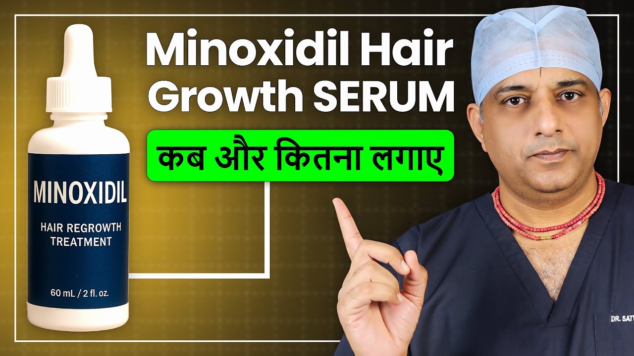 बाल तेज़ी से उगेंगे ऐसे लगाए MINOXIDIL Hair Growth Serum | Minoxidil Hair Regrowth Results