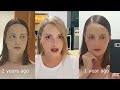 Things I didn't expect after transgender FFS - Facial feminization