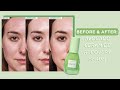 Before &amp; After Journey with the Avocado Ceramide Recovery Serum | Glow Recipe