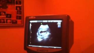 Ultrasound Sept. 16, 2013