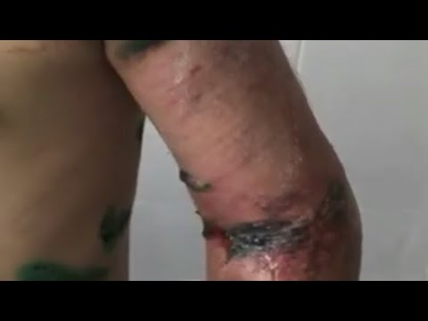 Вот что случилось с девочкой которую избила родная тетя