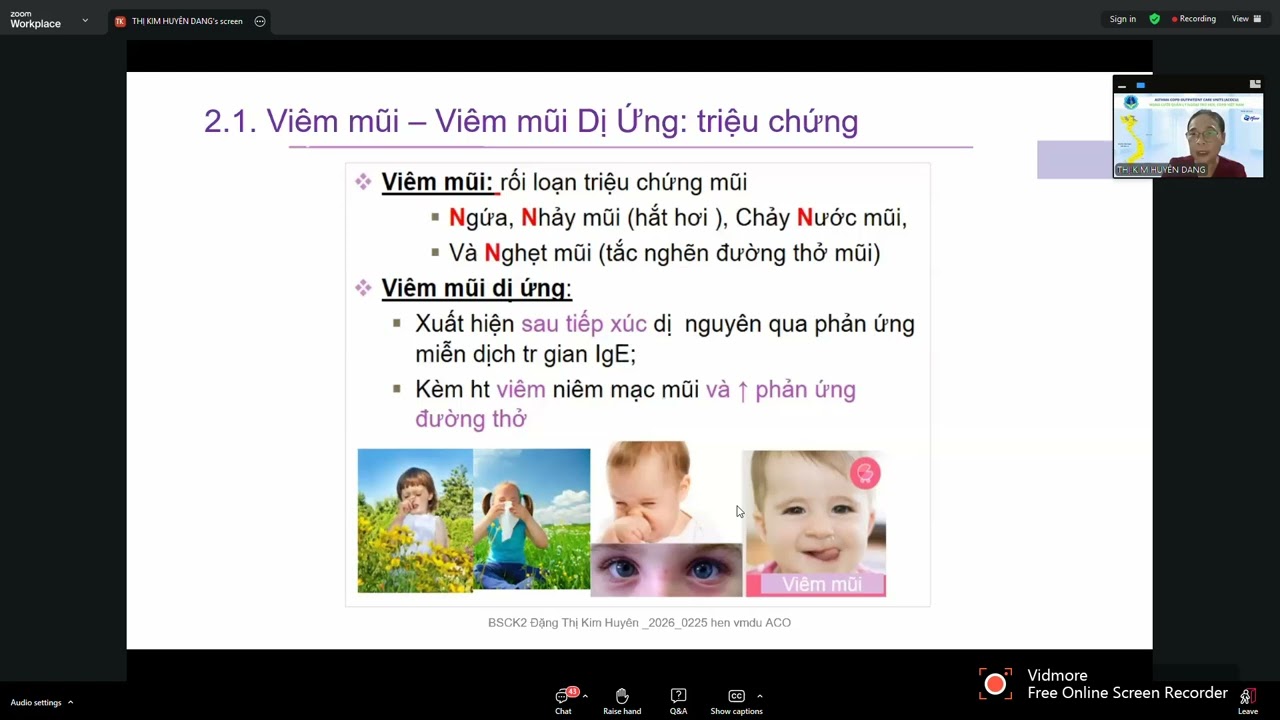 Hen và Viêm mũi dị ứng ở trẻ em