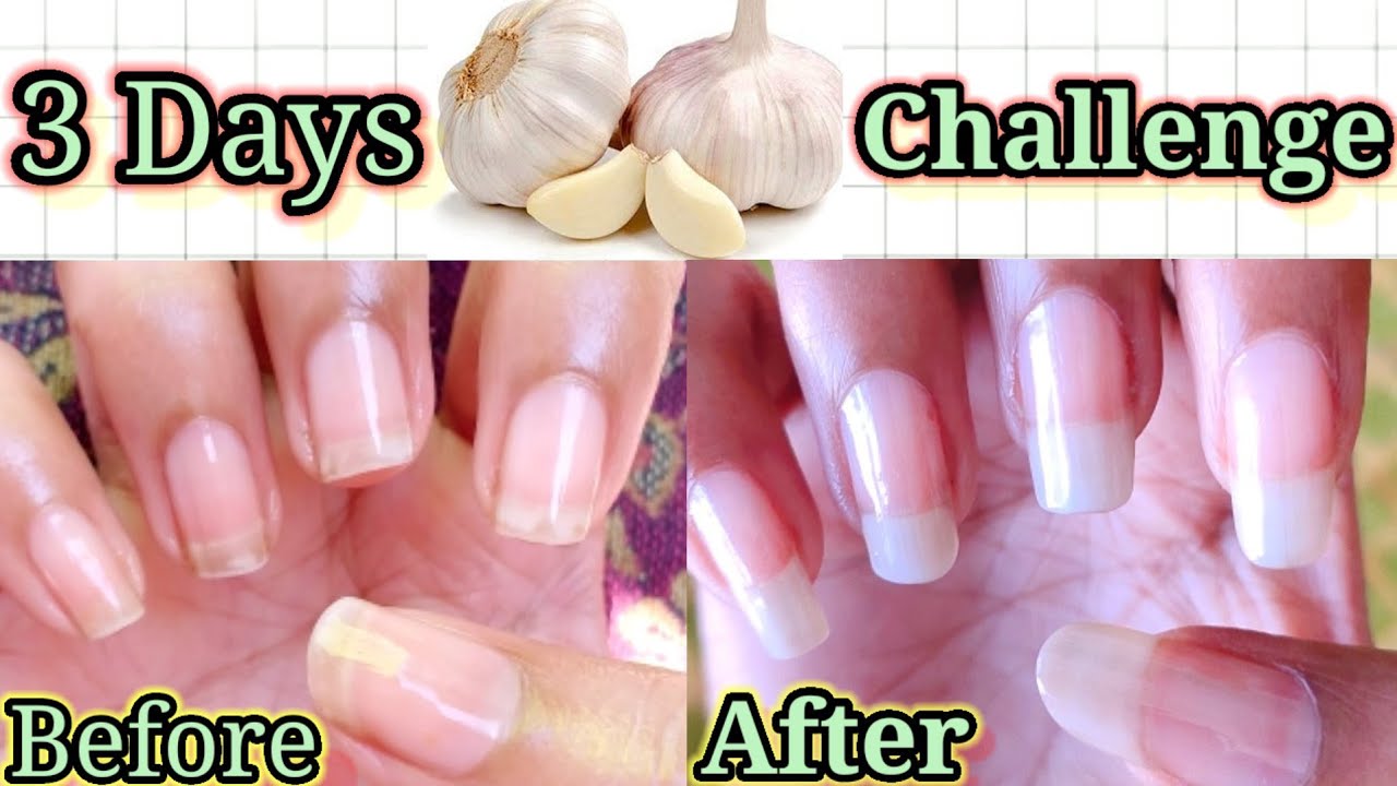 How to grow nails fast with Garlic ? |How to grow nails fast @ManjuCreation  - YouTube