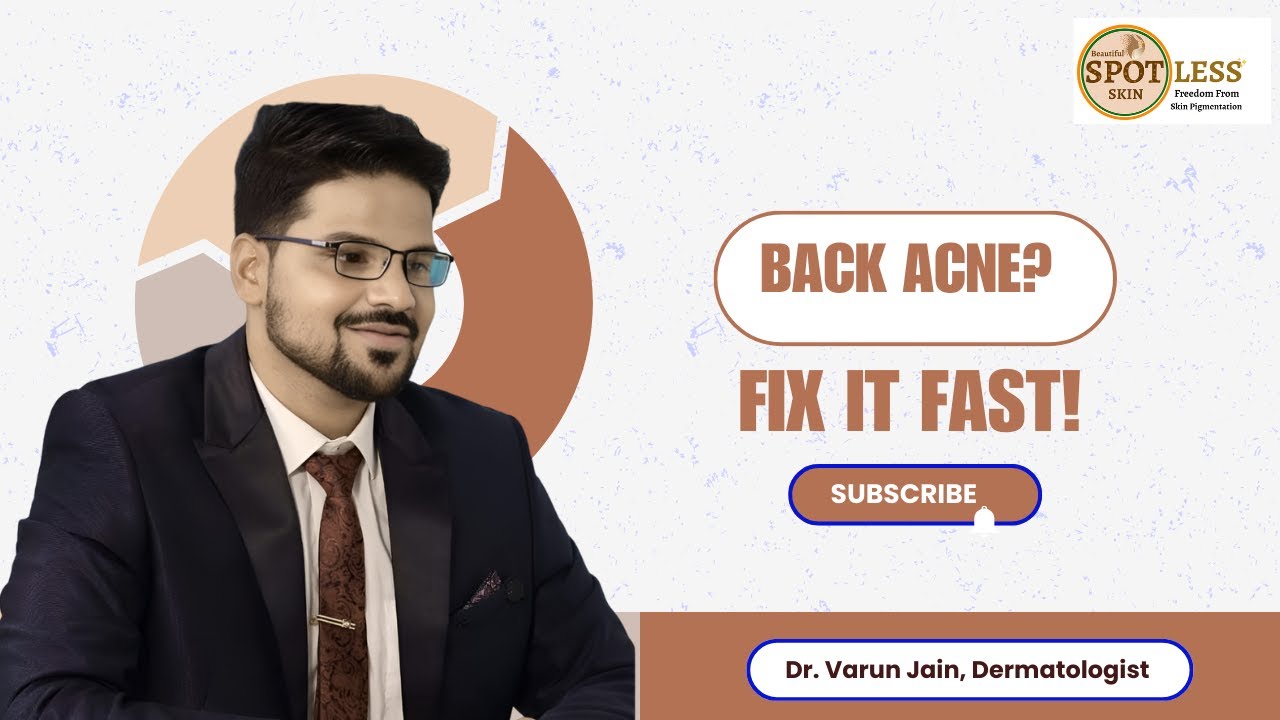 How to Get Rid of Back Acne? 🛑 Treatment & Prevention | Dr. Varun Jain