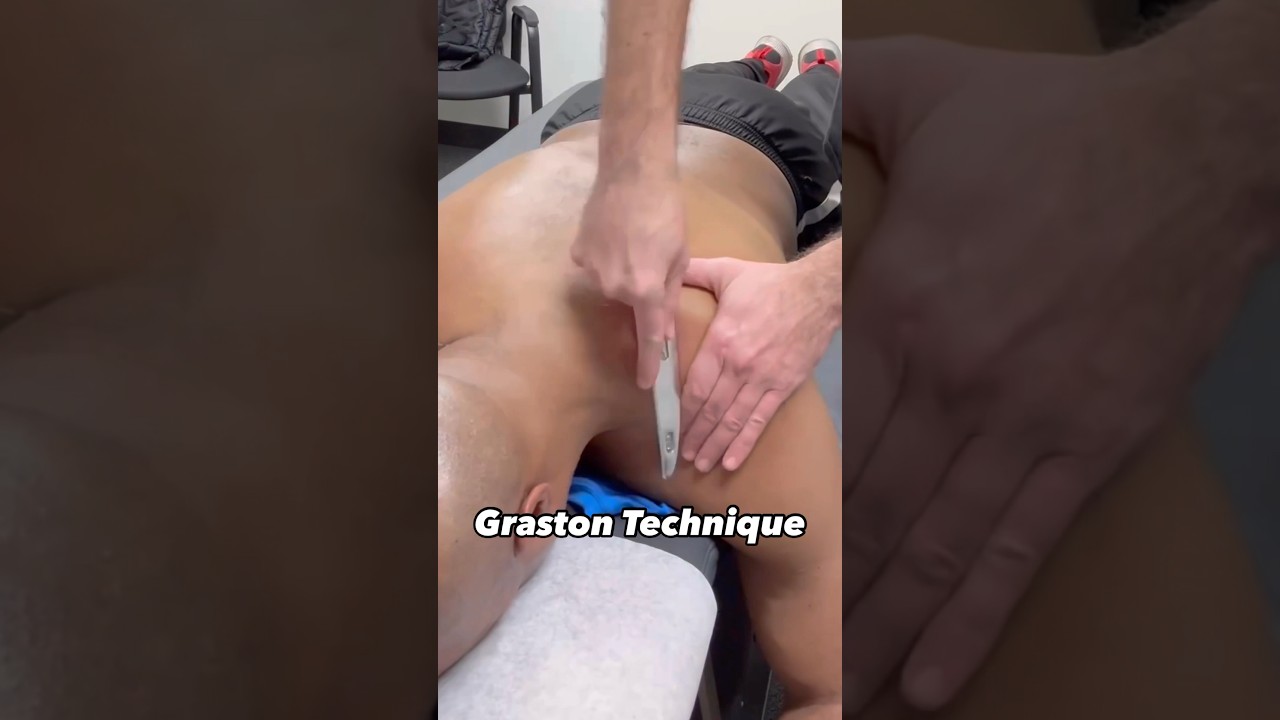 Graston Technique for an Upper Trap Strain