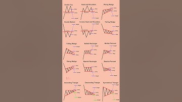Chart patterns every trader needs to master || Stock market chart patterns || #stockmarket #viral