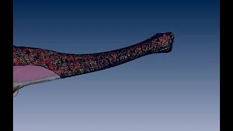 3D Bone Reconstruction