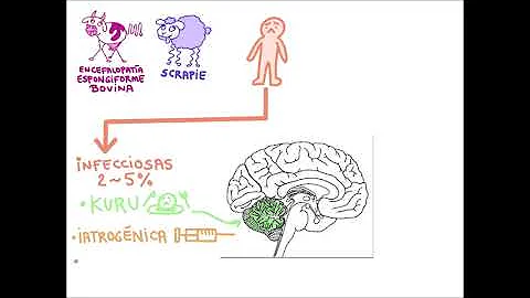 ¿Cuáles son las 5 enfermedades causadas por priones?