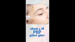 Platelet-rich plasma (PRP)  ප්‍රතිකාර ක්‍රමය සහ එහි ඇති වැදගත් කම (