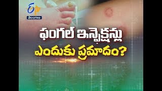 Fungal Infections and Skin Health | Health Tip | 28th October 2019 | ETV Telangana
