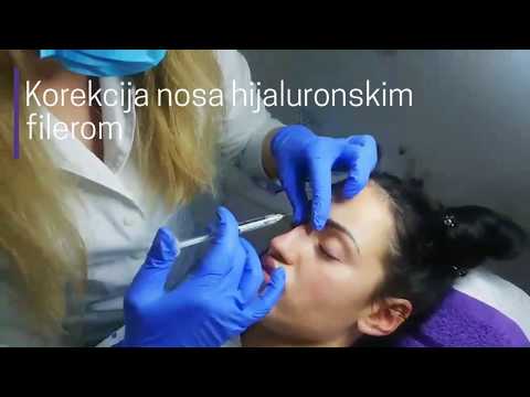 Nehirurško podmlađivanje lica i tela