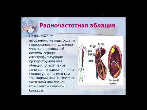 9:50 Современные методы диагностики и малоинвазивного оперативного лечения заболеваний сердца