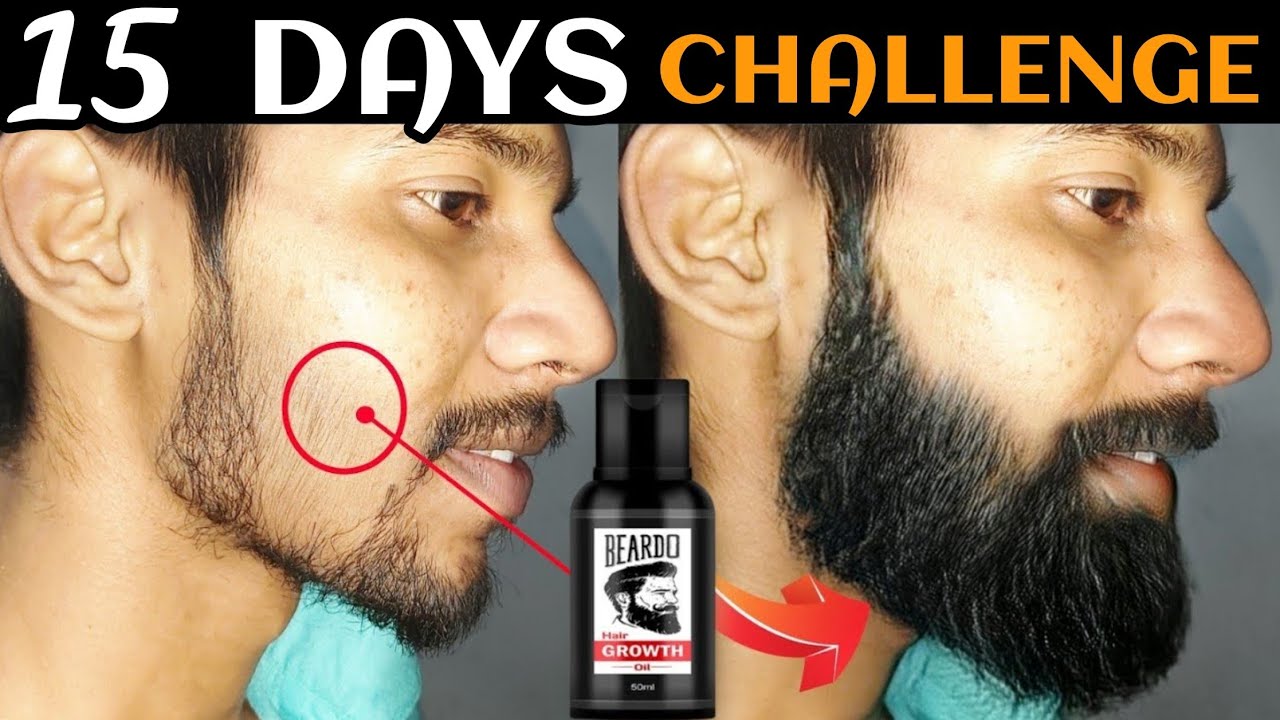 Beardo Hair Growth Oil After 15 Days Review | Best Beard Oil For Patchy Beard in India 2025 !