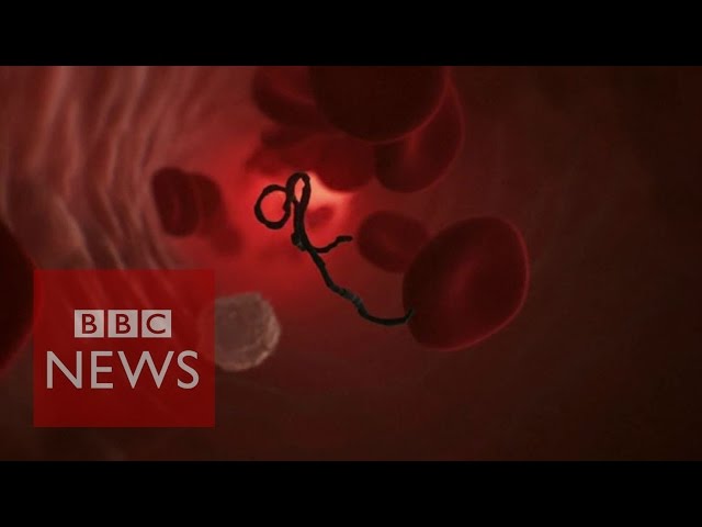 How does Ebola attack human cells? BBC News class=