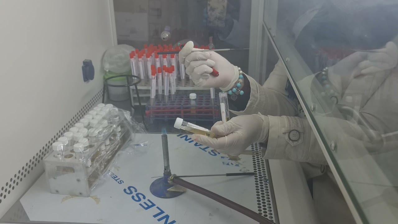 مختبر الاحياء المجهريه (عمليه زرع البكتيريا )