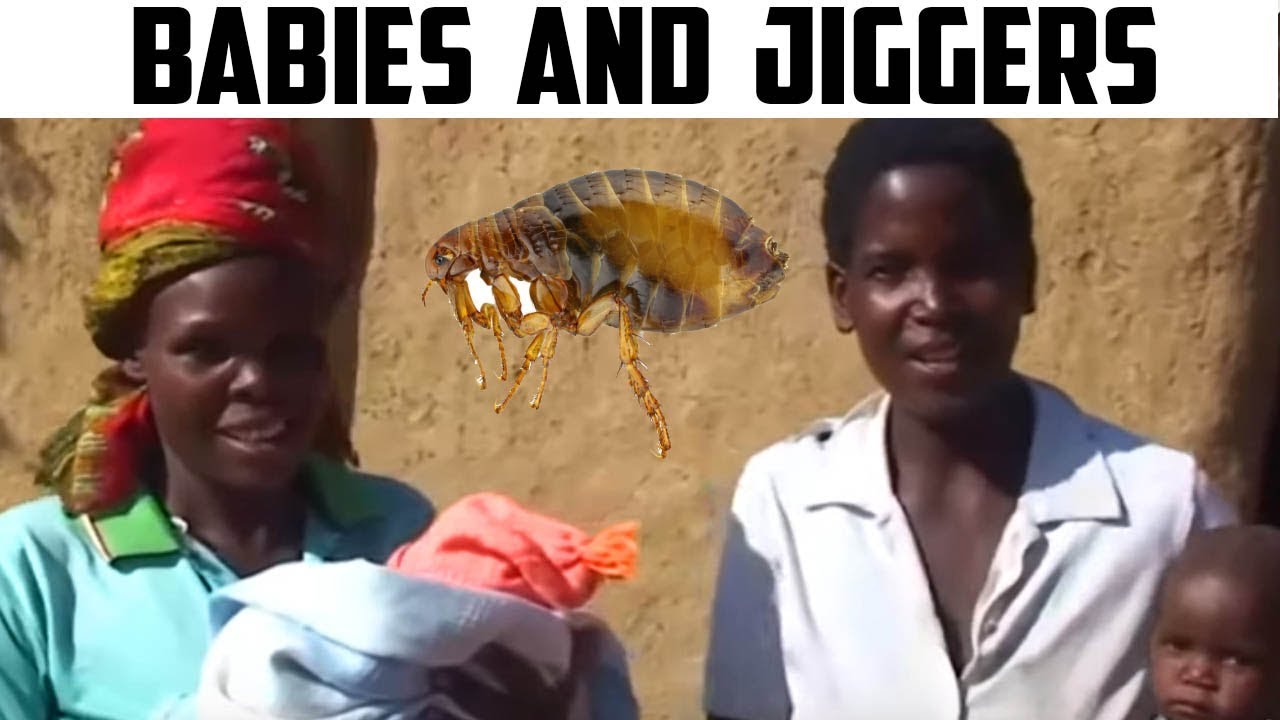 Cement Floor Protects Baby from Jiggers YouTube