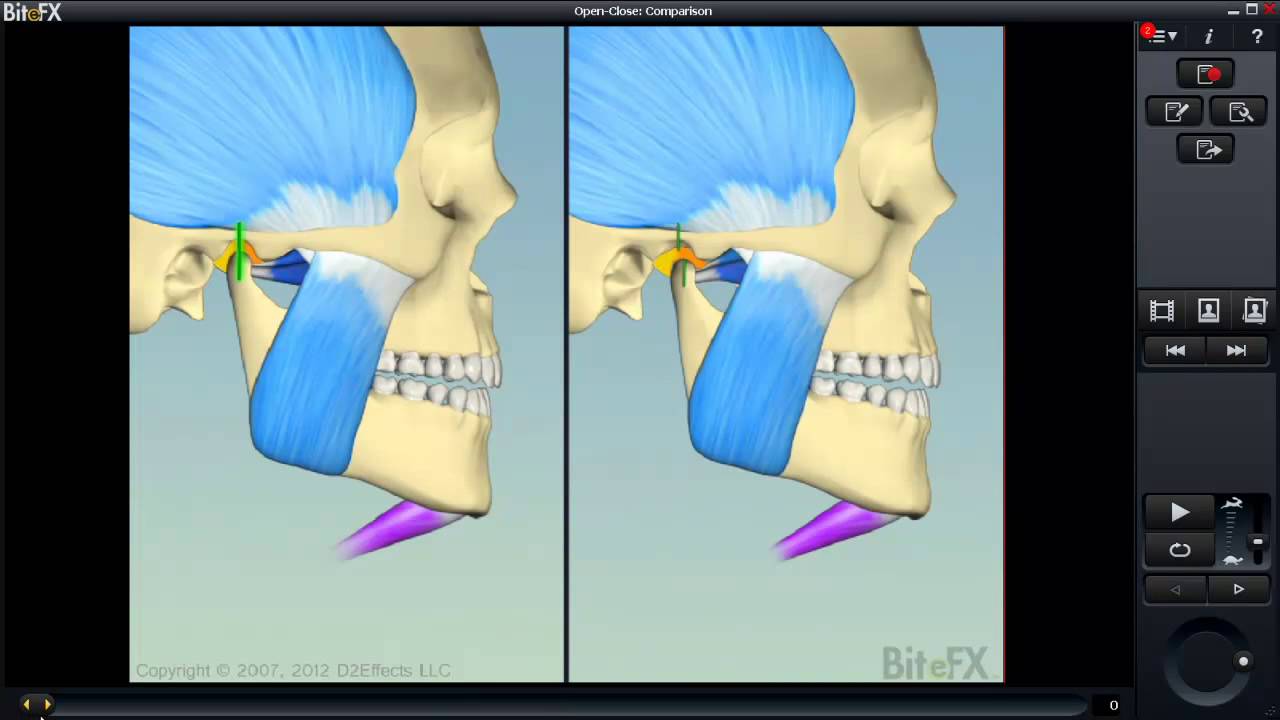 why you may need a dental splint youtube centric relation