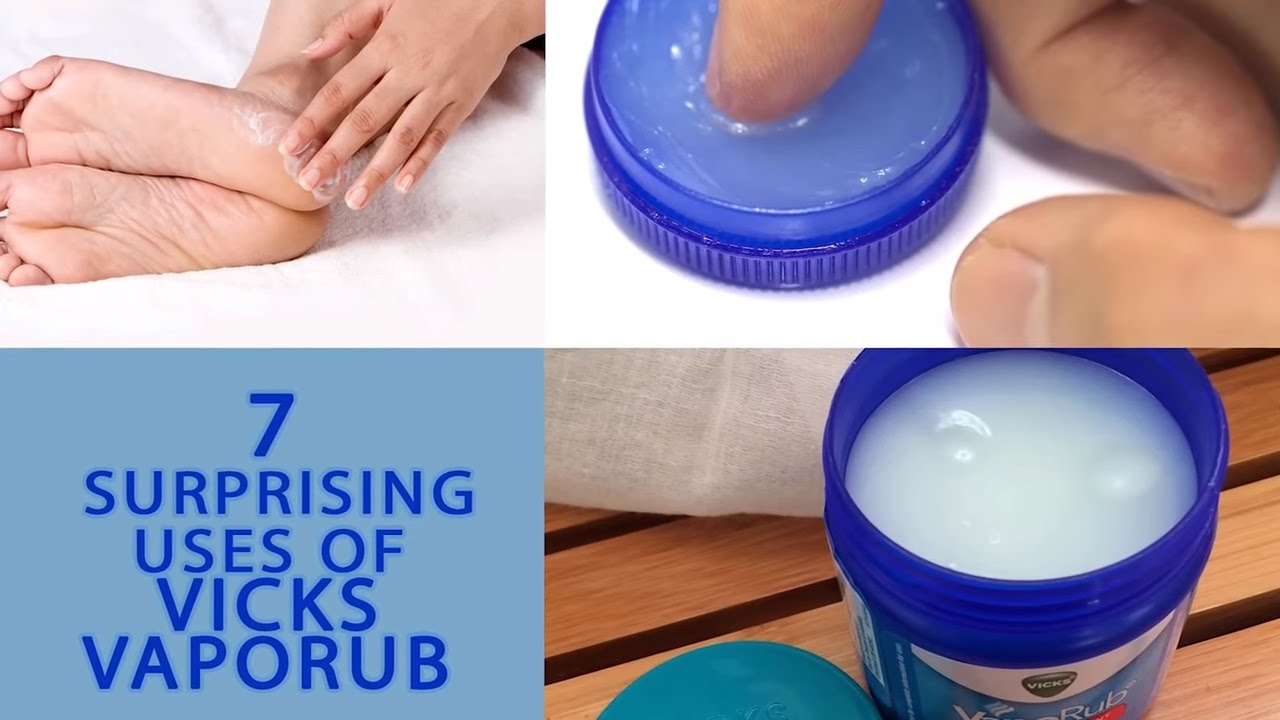 7 Surprising Uses Of Vicks Vaporub | Amazing Uses & Benefits of Vicks