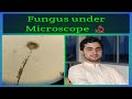 Fungus Under Microscope E Learn With Technologist Fungus Under Microscope E Learn With Technologist
