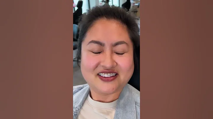 BRACES HACK!! How To Put Rubber Bands On Braces 😬