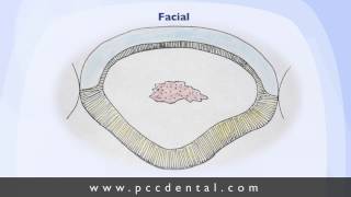Ask Gordon tooth preparations for veneers