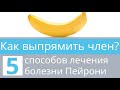 Как выпрямить член? Узнайте секреты лечения болезни Пейрони и 5 способов исправить кривой пенис!