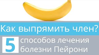 Как выпрямить член? Узнайте секреты лечения болезни Пейрони и 5 способов исправить кривой пенис! Как выпрямить член? Узнайте секреты лечения болезни Пейрони и 5 способов исправить кривой пенис!