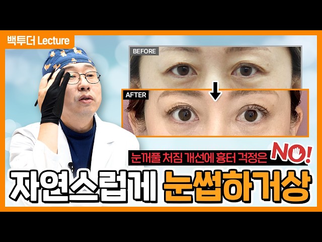 [눈썹하거상] 절개 흉터, 티 난다?┃실제 회복 과정 타임라인 공개!!