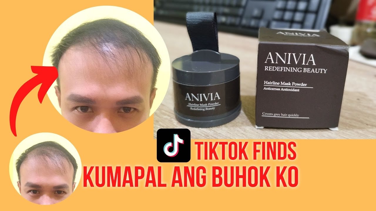TEMPORARY SOLUTION TO THINNING HAIR | Anivia Hair Mask Powder REVIEW | Treatment & Remedy