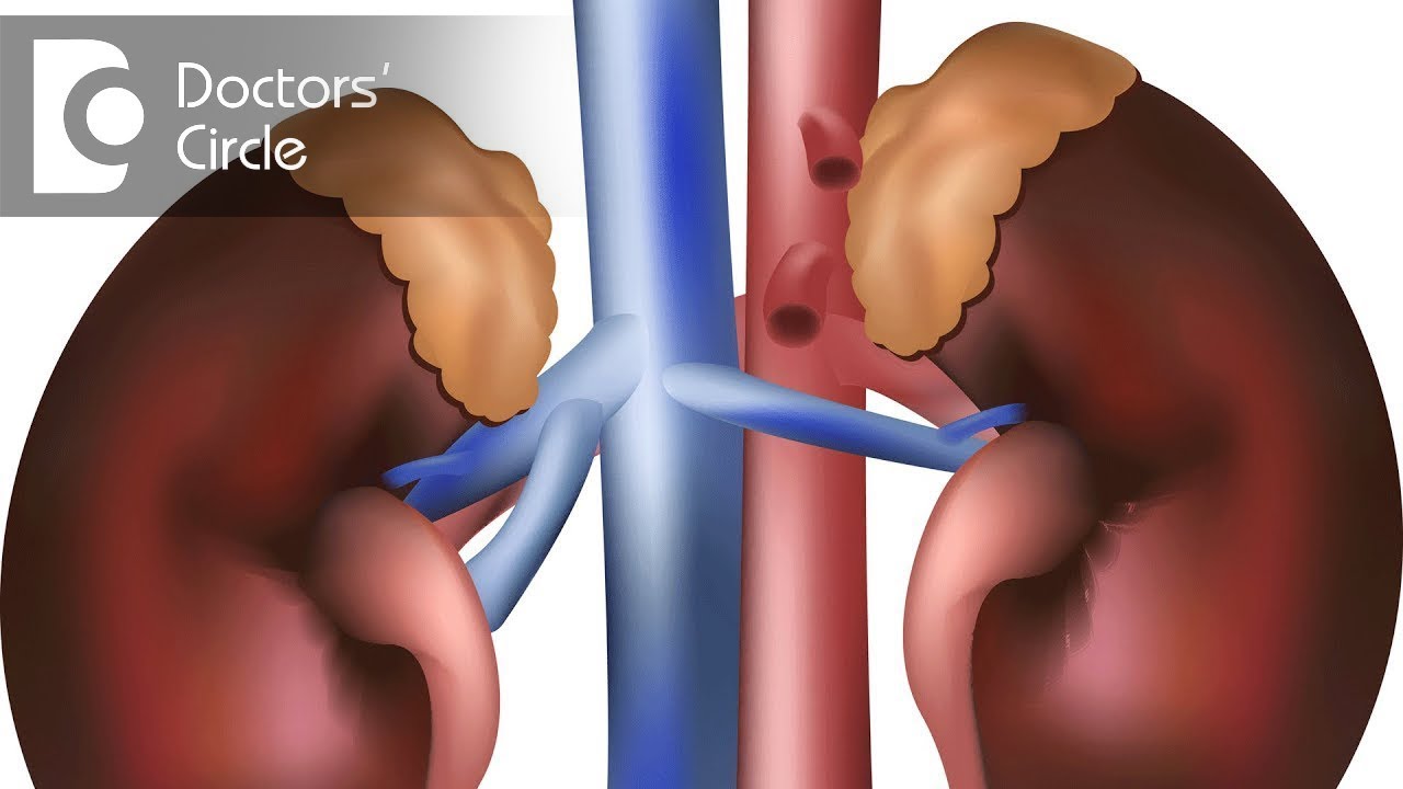 How To Recognise Signs Of Adrenal Gland Benign Tumor? - Dr. Anantharaman Ramakrishnan