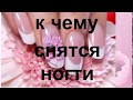 Увидеть ногти во сне.Сонник от Ирины