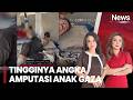 Warga Histeris! Tingginya Angka Amputasi Anak Gaza, Dokter Terpaksa Amputasi Tanpa Bius |iSore (3/5)