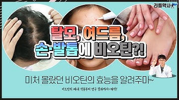 탈모, 여드름, 손·발톱에 비오틴?! 미처 몰랐던 비오틴의 효능을 알려주마~지방, 탄수화물, 단백질 대사에 필요한 비오틴!