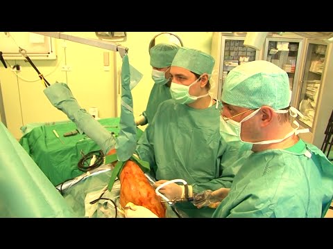 Артроскопическая хирургия в ECSTO