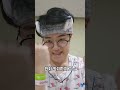 조혈모세포이식