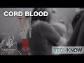 Cord Blood - TechKnow