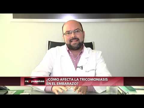 Video: Cómo reconocer los síntomas de la tricomoniasis (mujeres): 9 pasos