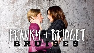 Franky & Bridget (Fridget) Season 5- Bruises