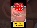 دەرهێنانی وێلاش دوای منالبون رەگەزی Baby Daik Explore دایک Love دهوک