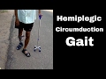 How does a Hemiplegic Walks in Circumduction Gait.