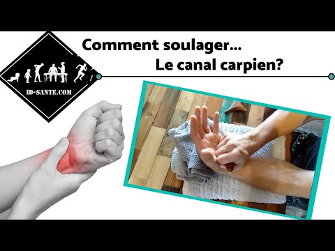 Vidéo: Soulagement Du Canal Carpien: 9 Remèdes Maison