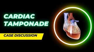 Case Discussion || Cardiac Tamponade Update