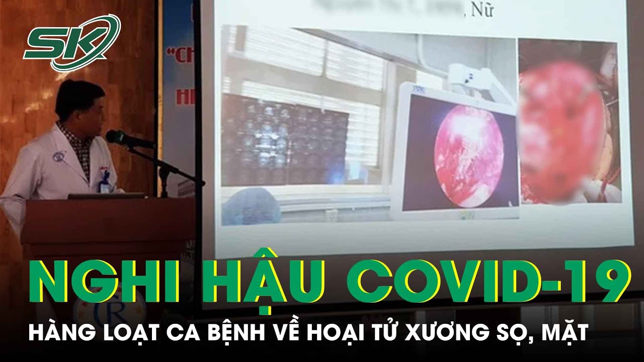 TP.HCM:  Nghi Do Hậu Covid-19, Xuất Hiện Hàng Loạt Bệnh Nhân Bị Hoại Tử Xương Sọ, Mặt | SKĐS