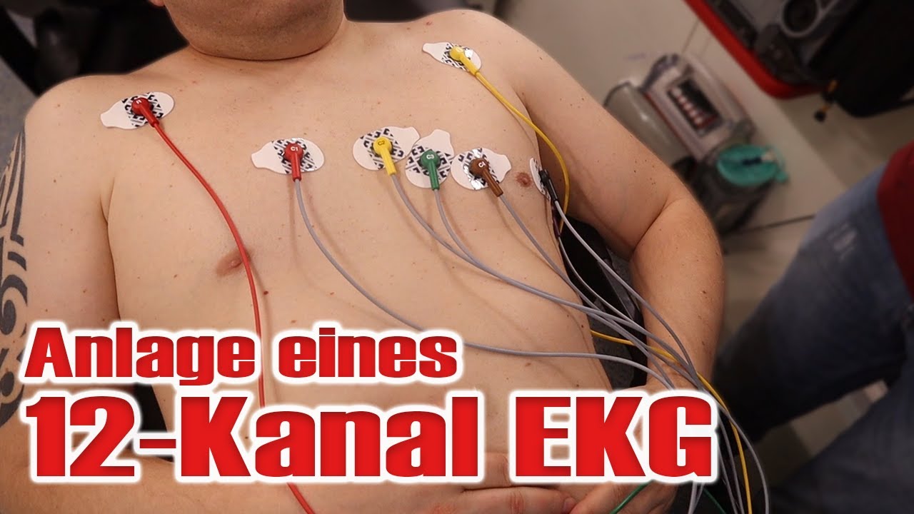 Kanal ekg kleben 4 5 kanal