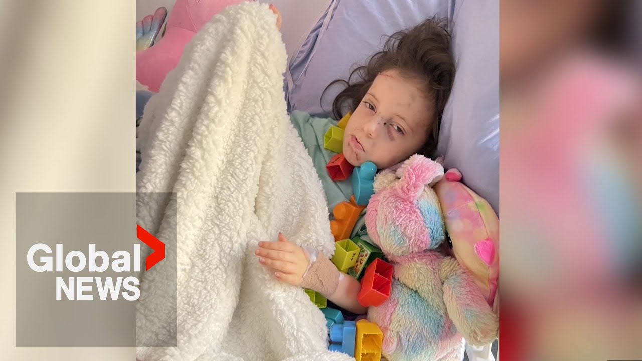 5-year-old Alberta girl attacked by dogs on First Nations reserve