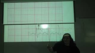 EKG Basics Part 6- Measuring Ventricular HR & Complexes