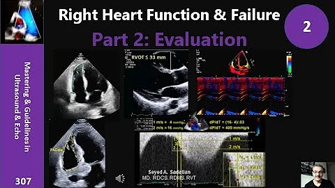 Right Heart Function & Failure Part 2: Evaluation